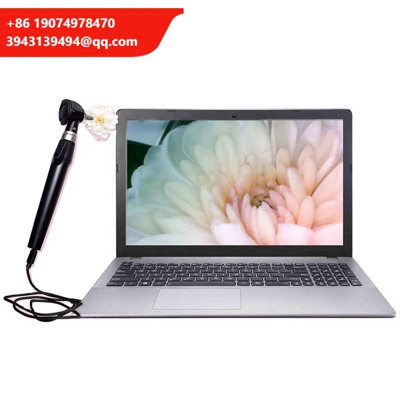 

Прямые поставки с завода: Прочный и портативный цифровой видеоотоскоп с камерой, медицинское USB-устройство для диагностики уха