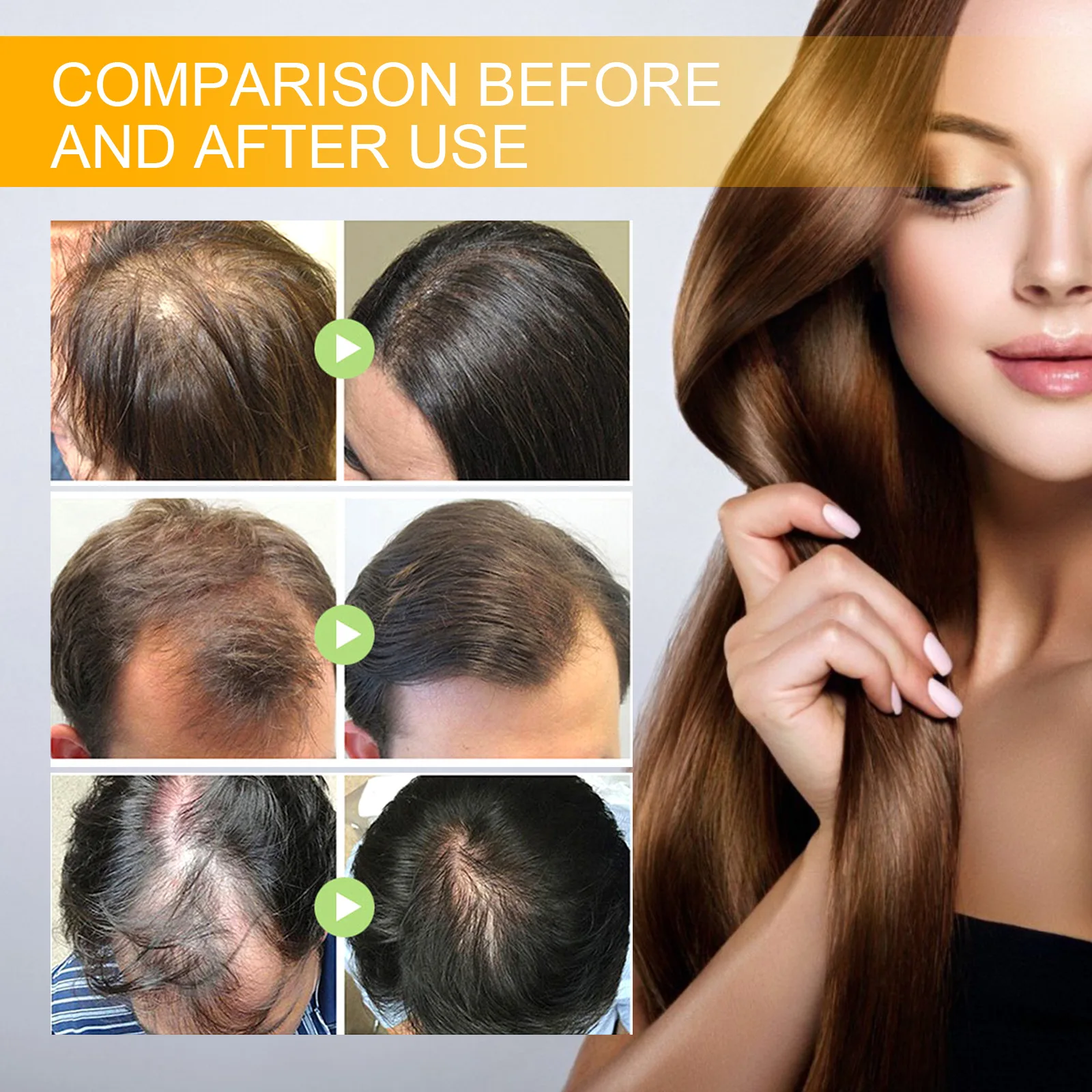 Produk semprotan penumbuh rambut cepat Serum anti-rambut rontok perawatan kulit kepala kering rusak minyak esensial kecantikan rambut 30ml