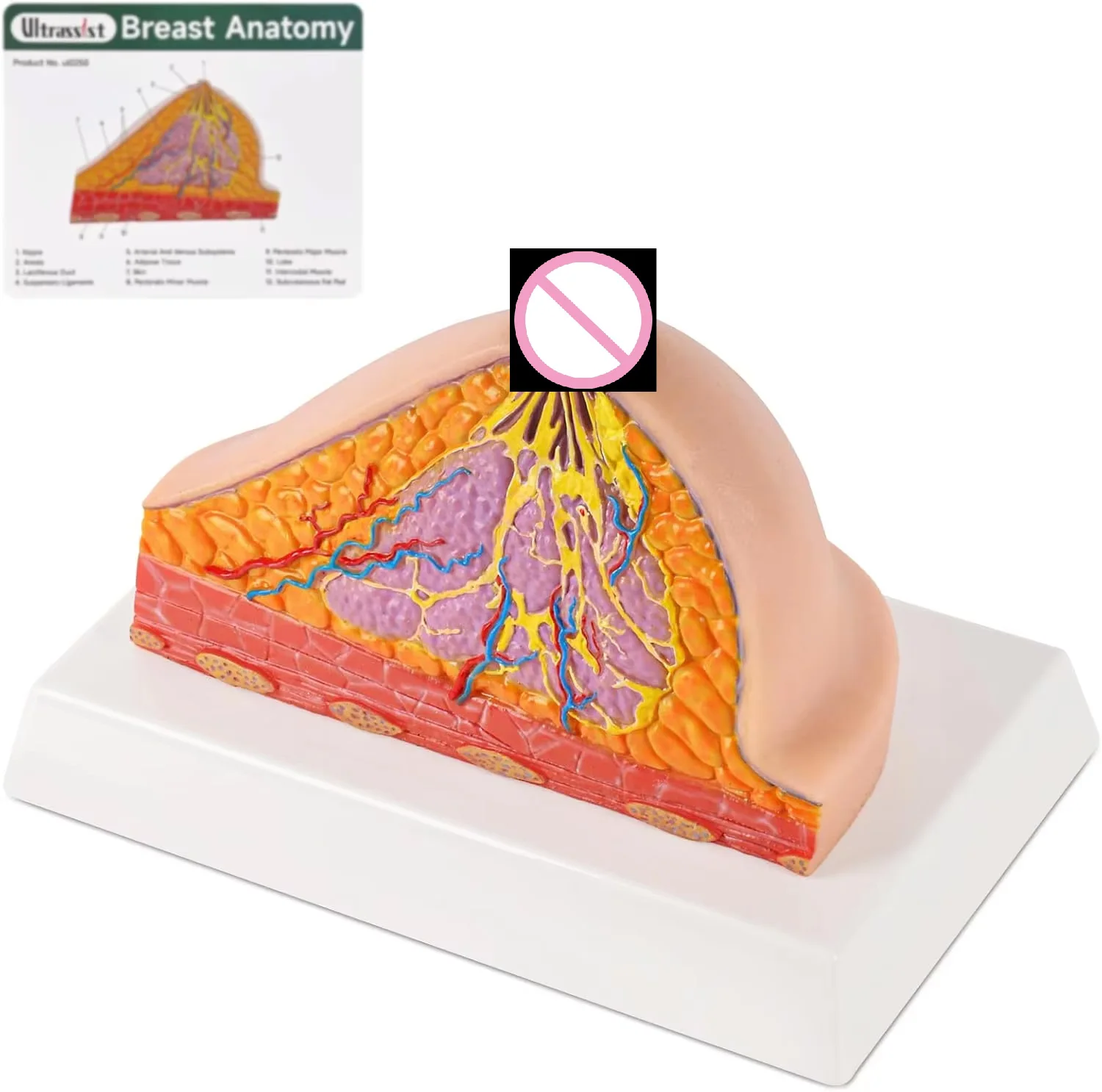 Ultrasist Breast Half Cross-Section Model Female Anatomy Silicone for Medical Patient Education Self-Exam Practice Training