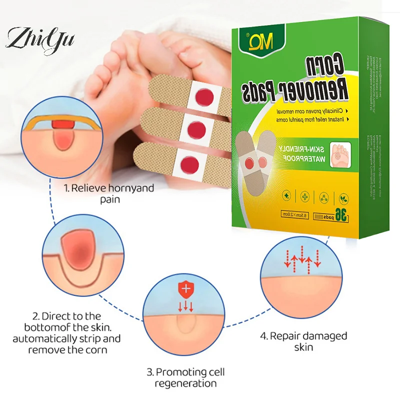 36 pièces autocollant de soin des pieds Patch médical tampons d'élimination du maïs patchs curatifs callosités supprimer callosité détox été outils de soins des pieds