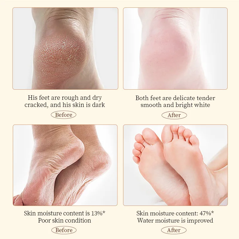 Anti Crack มือเท้าครีม Anti-Drying Heel Cracked Repair Feet Mask Removal Dead Skin Moisturizing Feet Care ผลิตภัณฑ์