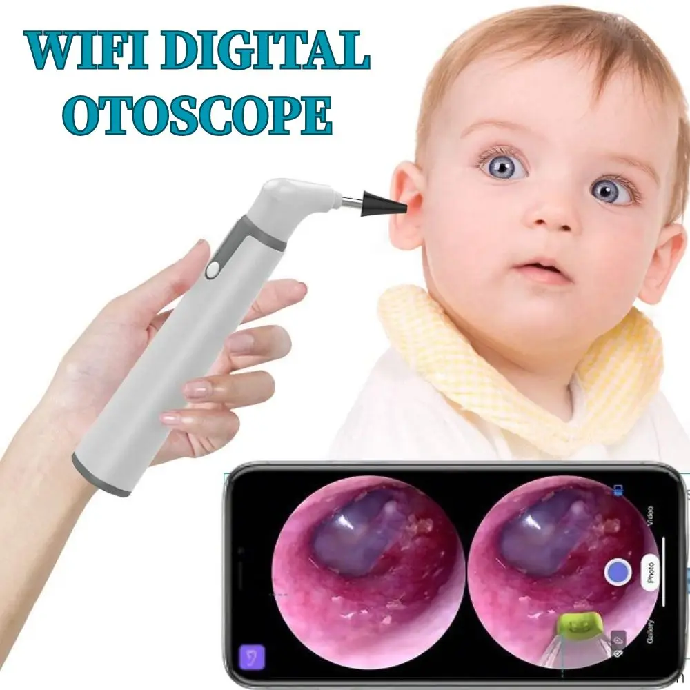

Teslong Ear Otoscope 3.9mm Smart Wireless Portable Visual Earwax Cleaning Endoscope Camera for iPhone Android Phone iPad
