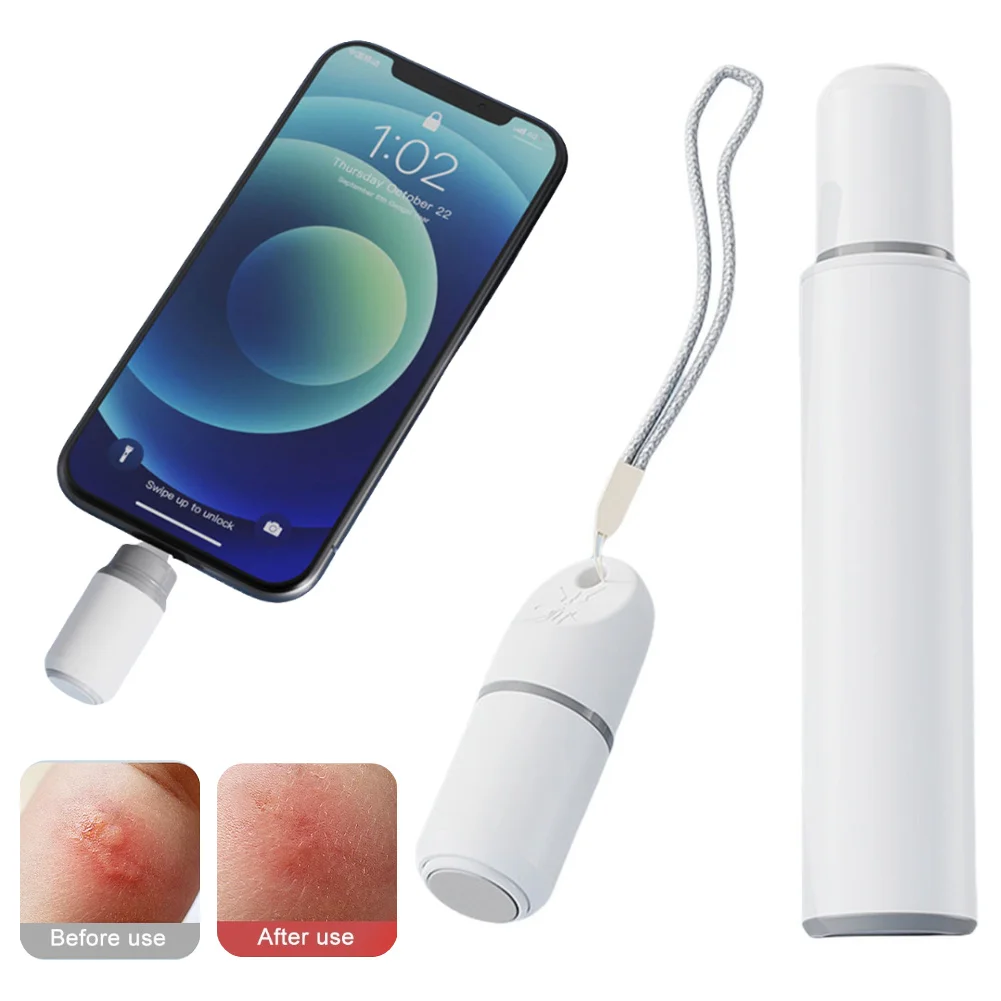 

Electronic Mosquito Bite Pen Natural Electric Insect Bite Healer Anti-Itch Pen for Adult Children for Camping Travel Outdoor