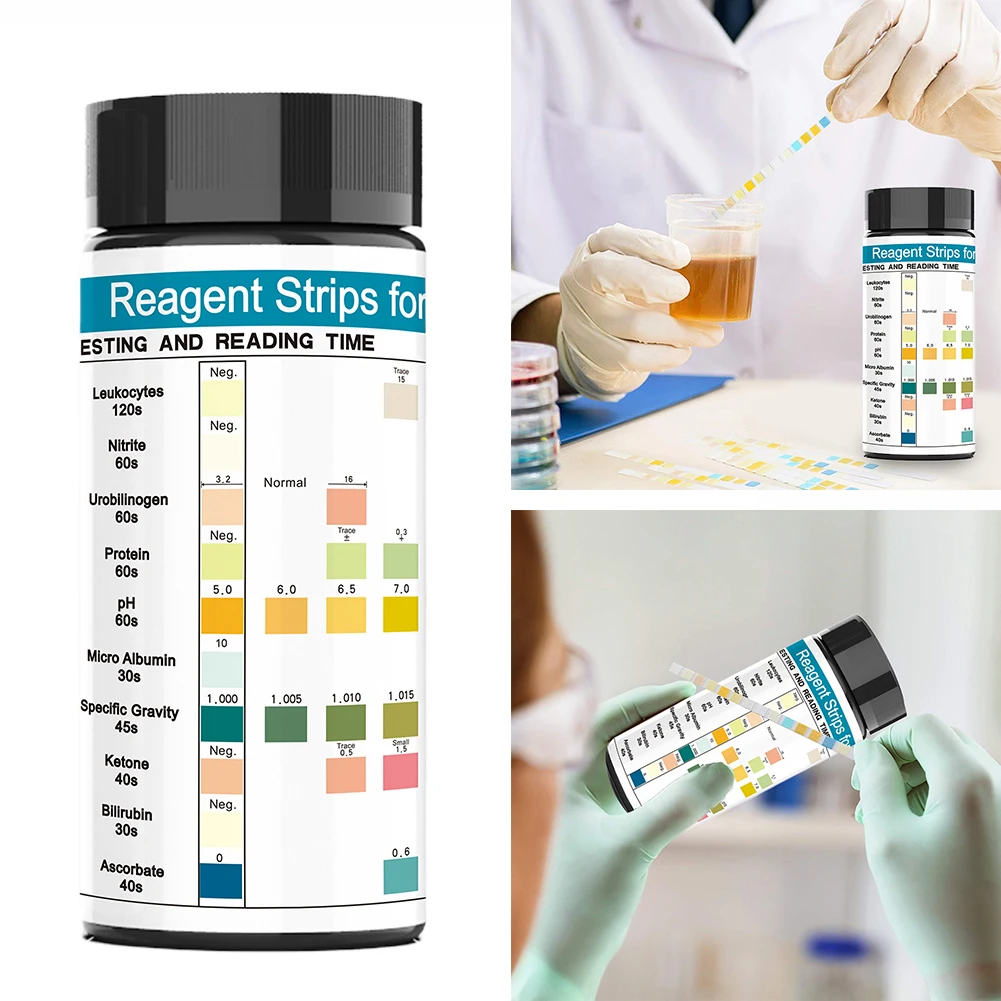 100 Strips Urine Test Strip 10 Parameters Protein Urinalysis PH Test Strips for Glucose Blood Specific Gravity Bilirubin