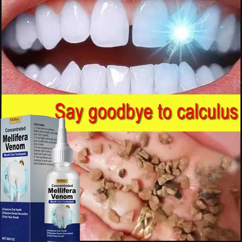 Tooth Whitening Essence Tooth Calculus Removing Dental Plaque Bad Breath Yellow Teeth Repairing Gums Teeth Cleaning Toothpaste
