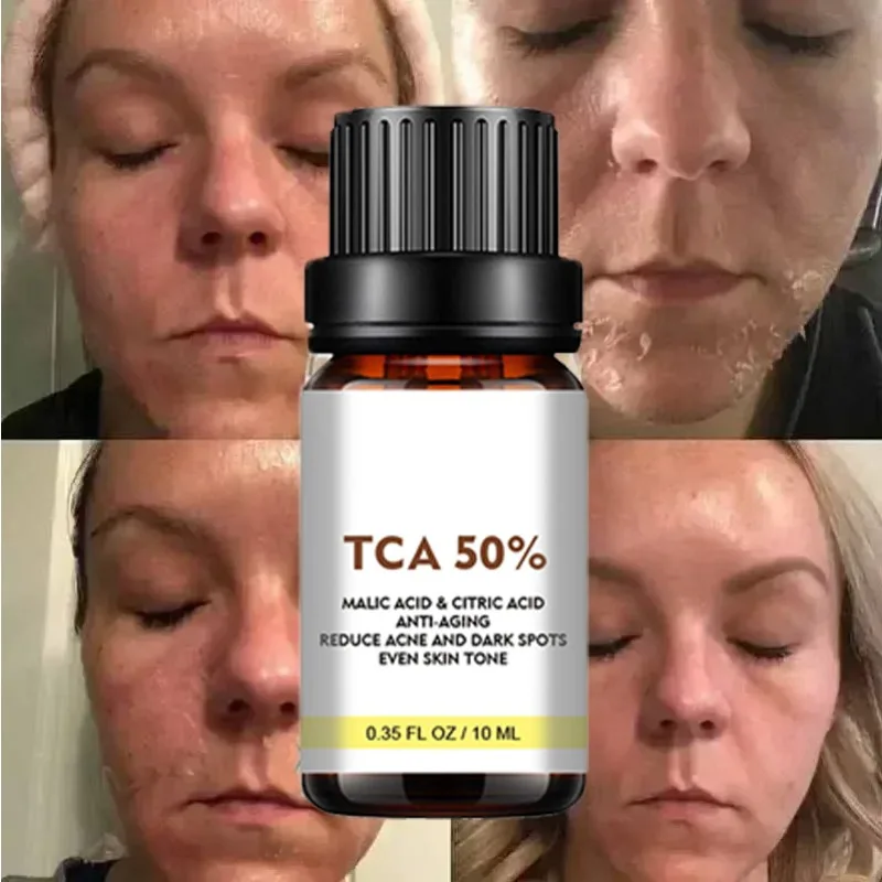 フェイスケア 角質除去 輝く肌 ダークスポットと色素沈着を薄くし、より明るい肌へ シミを除去 腕 膝 脚 メラニン