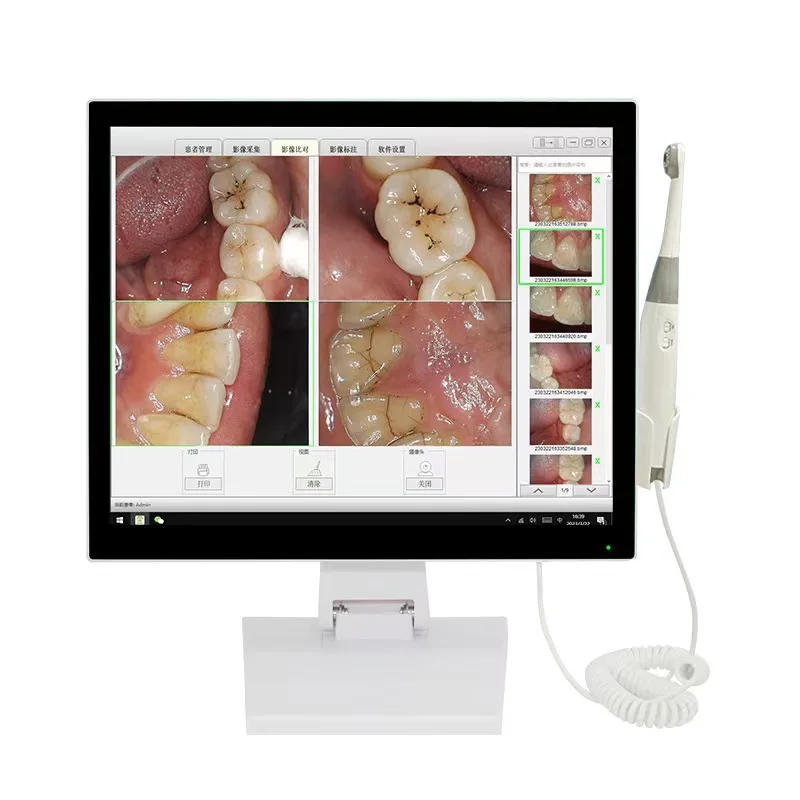 Oral Endoscope, 24-Inch All-in-One Machine, High Definition Touch Screen, Dental Clinic Hospital Special Cart, Medical Equipment