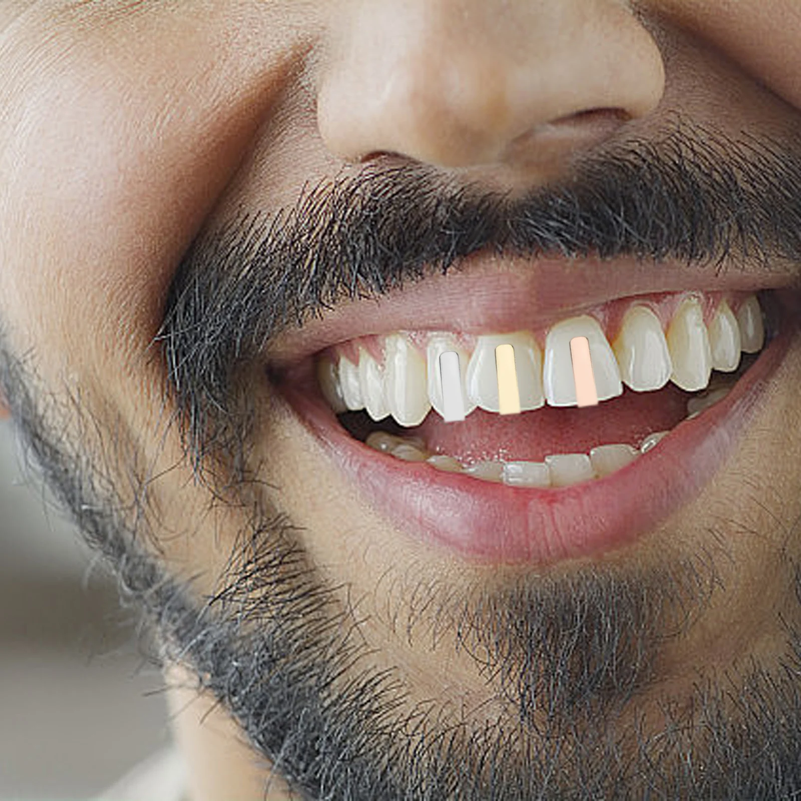 

3Pcs Hip Hop Dental Grill Caps Smooth Vertical Stripe Design Fake Tooth Cover for Men Women Trendy Mouth Jewelry Streetwear