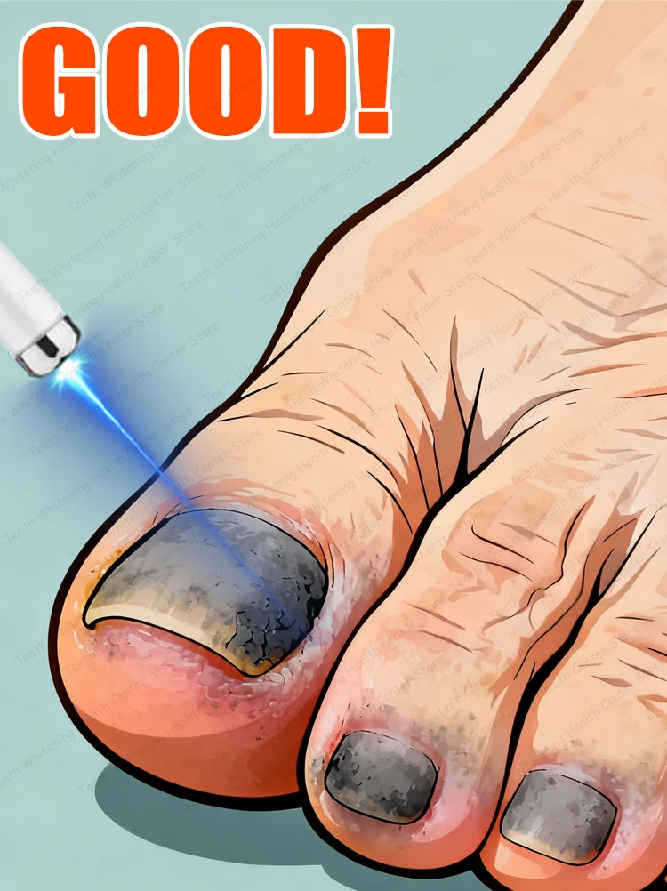 

Nail cleaning tools to restore nail health.