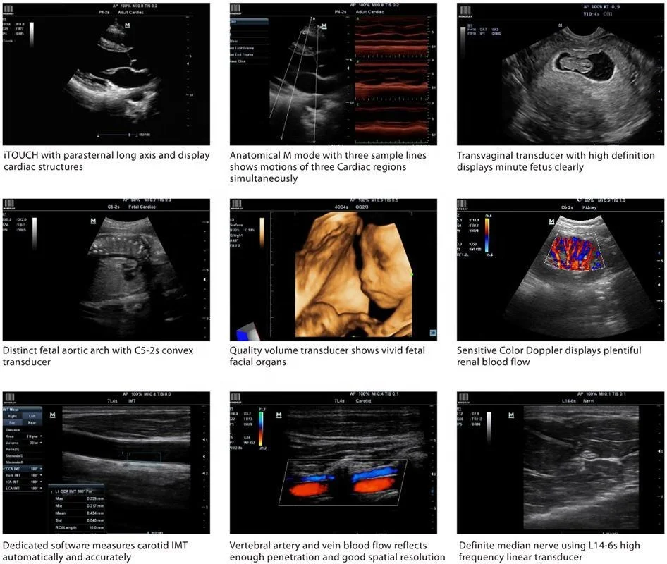 Mindray M7 Ultrasound For Sale