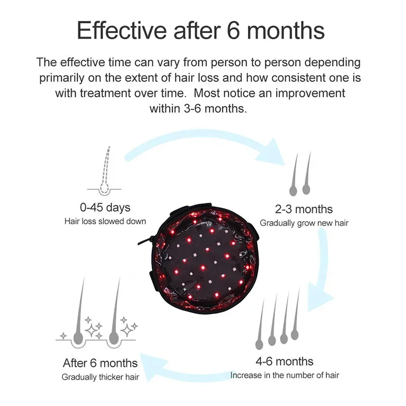 脱毛治療用レーザービーズキャップ,育毛ツール,脱毛防止,赤光療法,信号治療,急速充電製品,70個