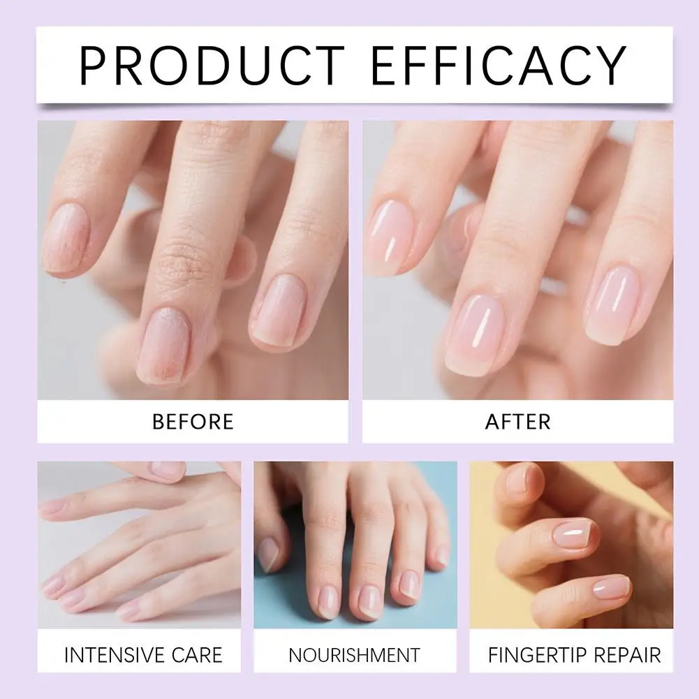 Olejek do skórek 3w1 w pisaku, odpychacz do skórek, pisak do paznokci, pisak do usuwania martwego naskórka i skórek, olejek do paznokci z ceramiczną końcówką do pielęgnacji paznokci