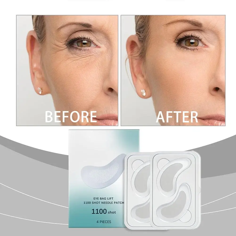 แผ่นแปะใต้ตาไมโครนีดเดิล แผ่นแปะใต้ตาไมโครนีดเดิลสำหรับริ้วรอย ริ้วรอยเล็กๆ บรรเทาผิวใต้ตาบวมอ่อนล้า H5E3