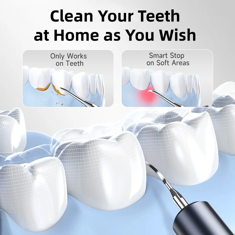 CURVY MOON T7 Elektrische Zahnaufhellung Zahnstein Scaler Plaque Kaffee Fleck Zahnstein Entfernung Hochfrequenz Sonic Zahnbürste
