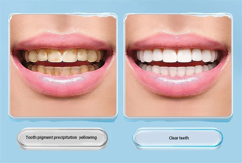 1/3/5PCS Zähne Fleck Radiergummi Schwamm Entferner Zahnstein/Tee/Rauch Flecken Kieferorthopädische Zahnbürste Mundpflege interdentalbürste Zähne – Detail 7