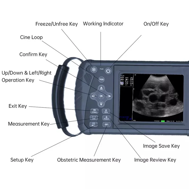 cheap veterinary ultrasound machine mini portable ultrasound laptop scanner veterinary ultrasound machine for cows