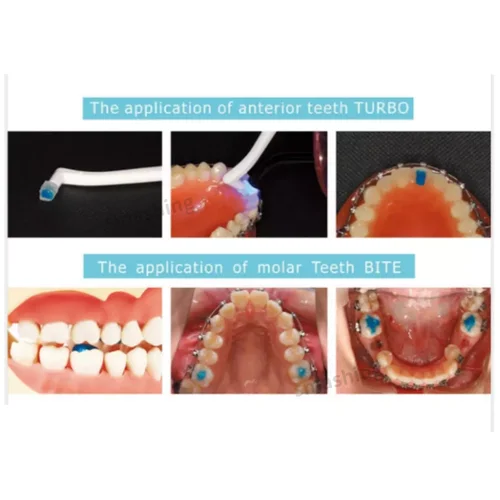 Imagen 2 del producto Adhesivo de ortodoncia de resina compuesta TURBO Dental, banda de curación de luz azul, solución de unión Dental confiable de alta calidad