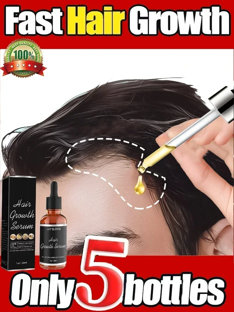 Hot sales Effective Fast Hair Growth Serum Baldness Repair Hereditary Postpartum Seborrheic Anti Loss Care for Men Women Scalp C