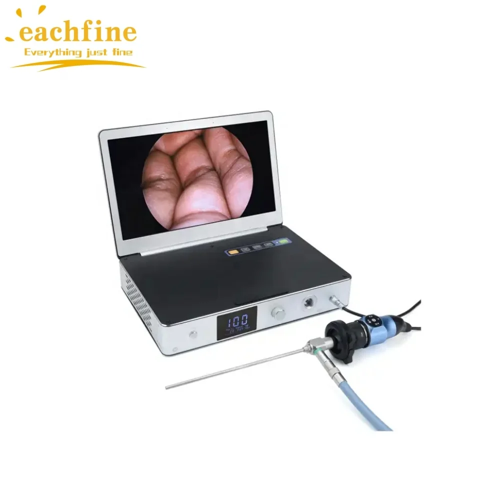 General Surgery Endoscopy Camera System Light Source ENT 11.6 Inch All in One Rigid Endoscopic 1080 HD 4K Endoscope Camera