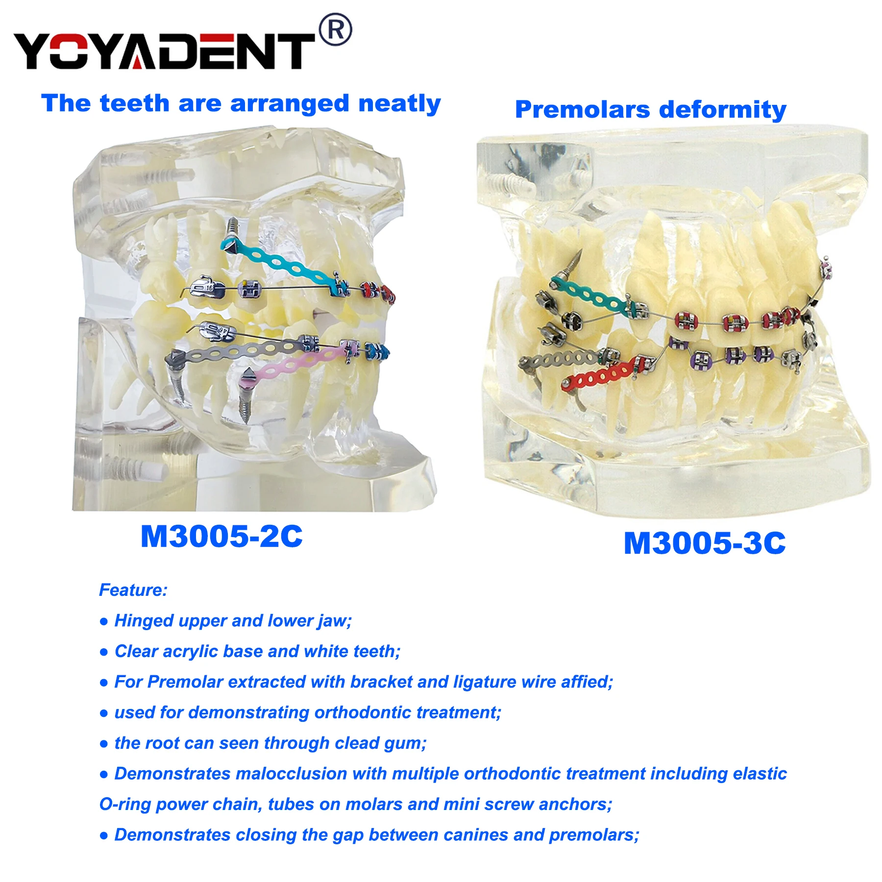 Dental Teeth Model Orthodontic Teeth Model Metal Arch Wires Ties/ Ceramic Brackets Orthodontic Correction Teaching