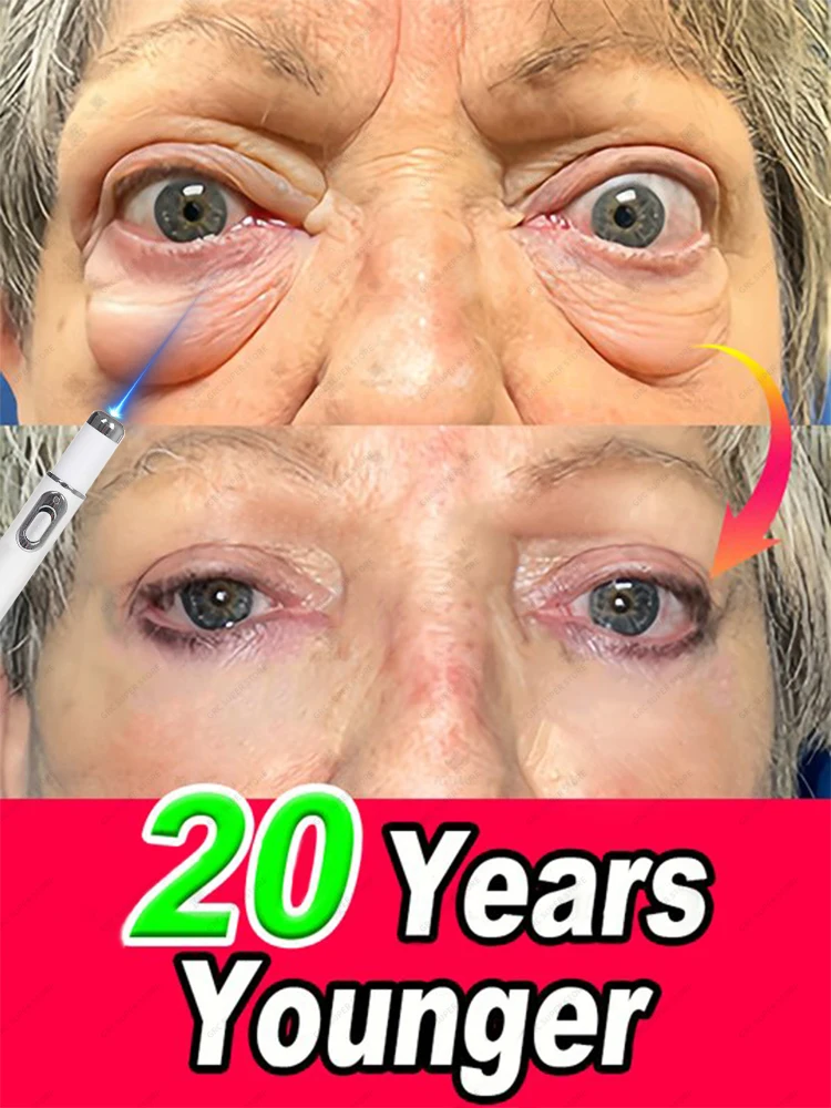

Solve all eye problems
