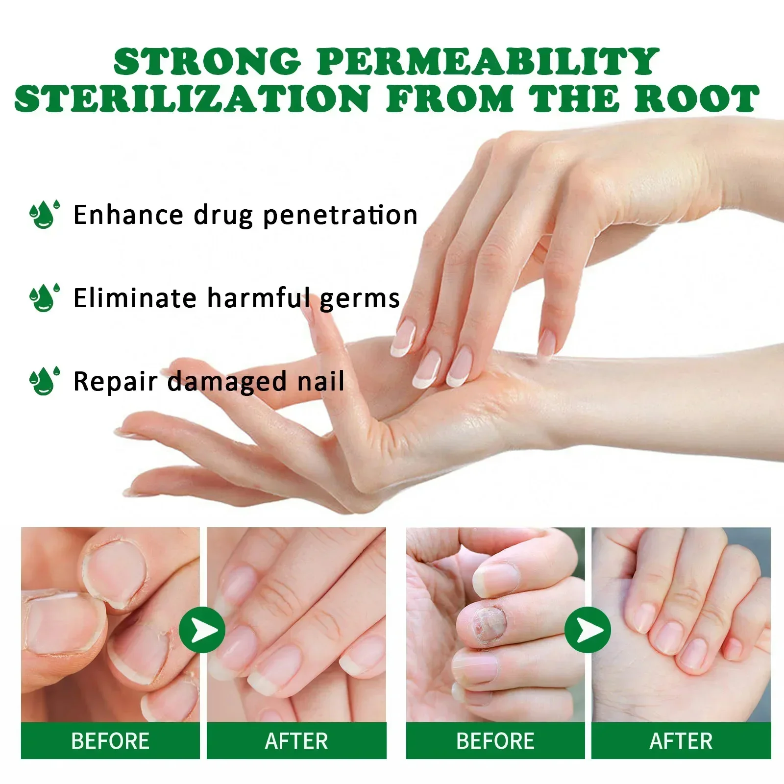 7 dias tratamento de fungos nas unhas essência óleo pé dedo do pé remoção de fungos nas unhas soro reparação onicomicosi anti infecção gel produtos de cuidados