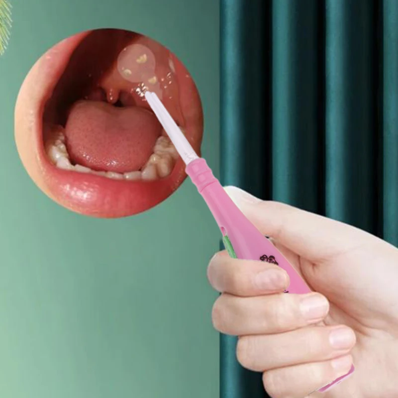 Tonsil Stone Remove…