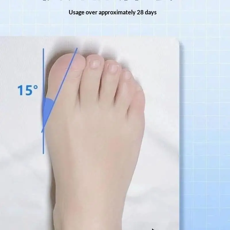 1 Stück verstellbarer Hallux-Valgus-Korrektor mit drehbarer Schnalle, Zehenspreizer, weicher und bequemer Hallux-Valgus-Deformationskorrektor, Fußpflege-Werkzeug. – Detail 10