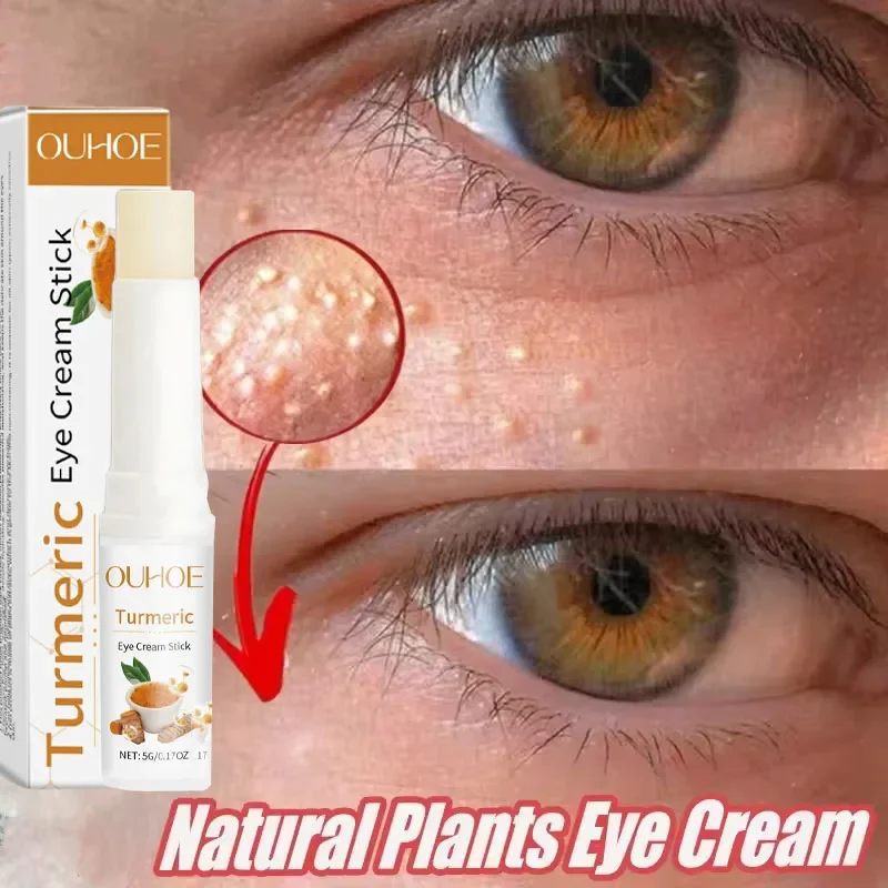 Eye Fat Granules Removal Eyestick Anti-Puffiness Firming Cream Anti Inflammatory Fade Fine Line Repair Skin Barrier Skin Care