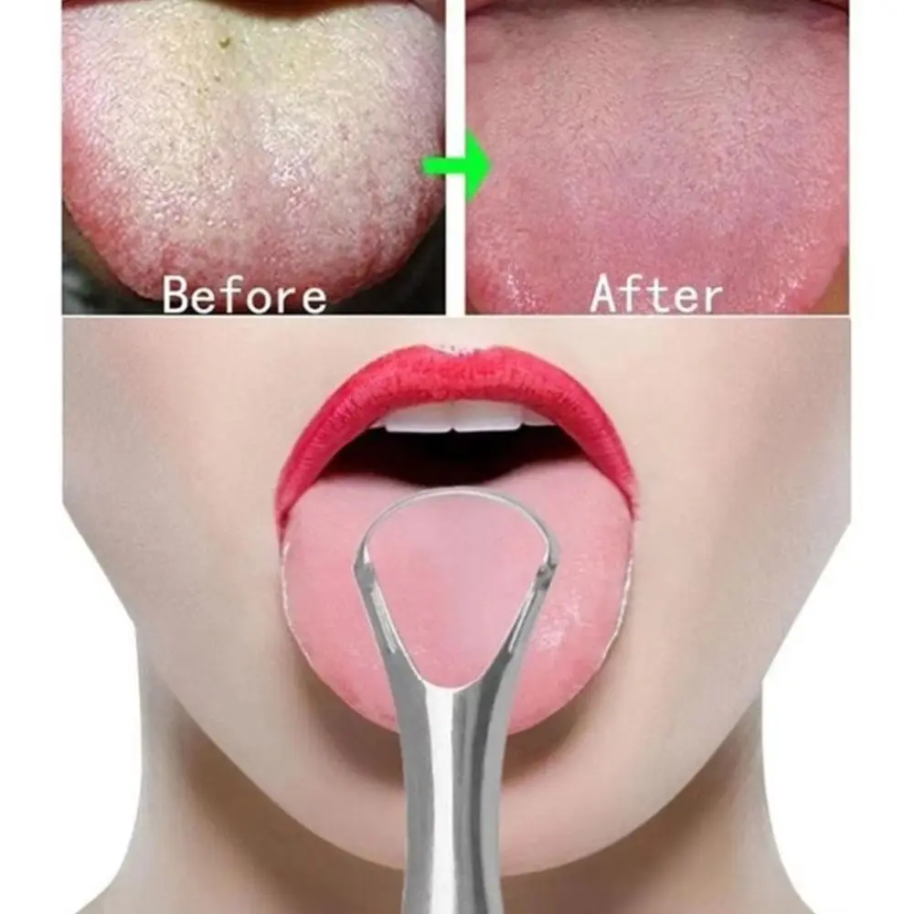 Portable Stainless Steel Tongue Scraper Silver Removing Bad Breath Halitosis Clean Oral Cleaner Tools Women Men