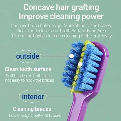Imagen 2 del producto Cepillos de dientes de ortodoncia para adultos, cepillo de dientes Dental, cepillo de dientes de cerdas suaves para el cuidado bucal, cepillo Interdental de limpieza уб comod Щетка