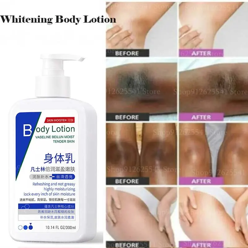 

300ml Whitening Body Cream Nicotinamide Brightening Vaseline Double Moisturizing Body Lotion Remove Chicken Skin Long Fragrance