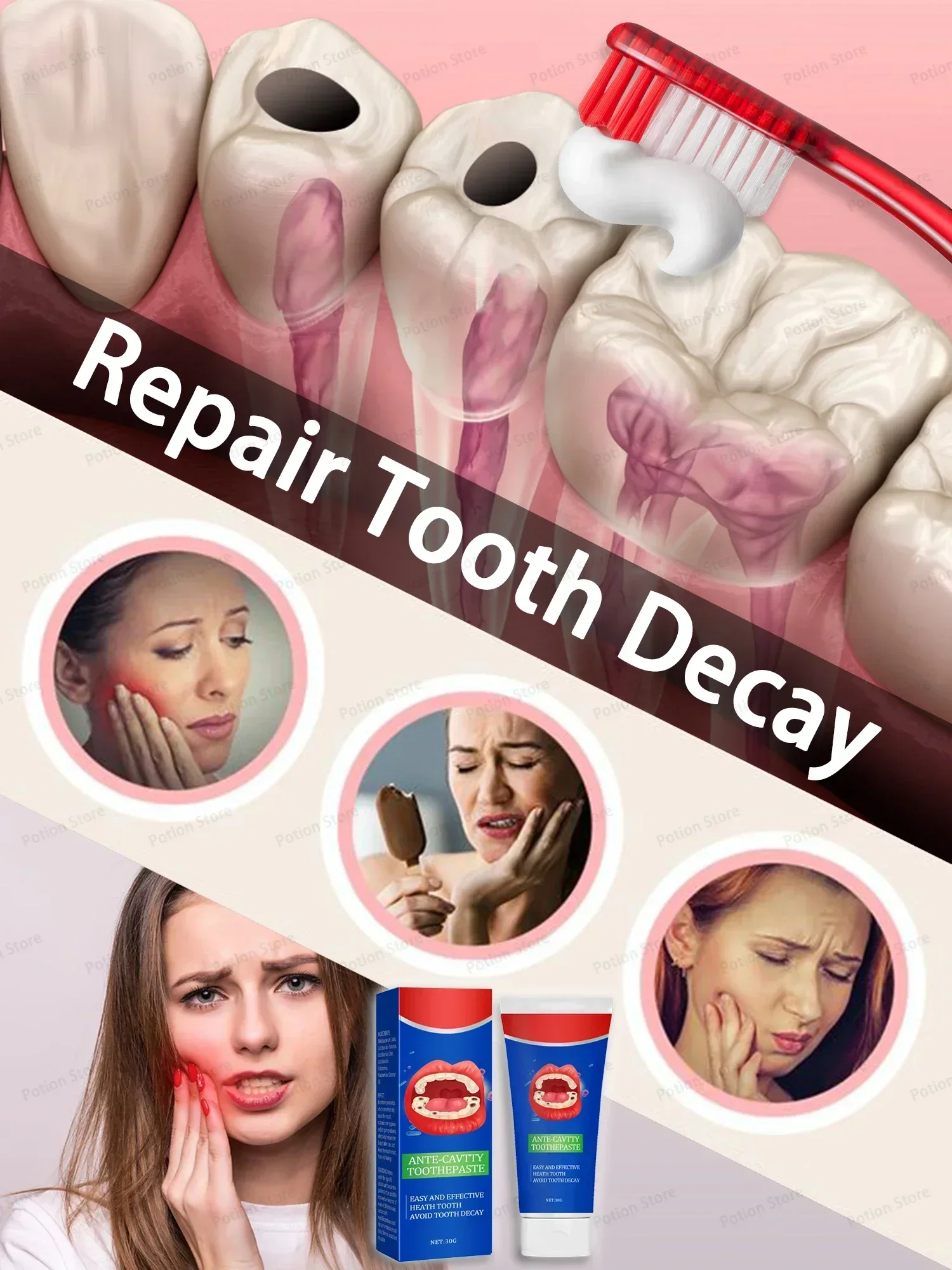 30g Anti Decay Toothpaste Dental Caries Repair Cream Prevent Tooth Decay Removing Dental Calculus Protect Teeth Freshens Breath