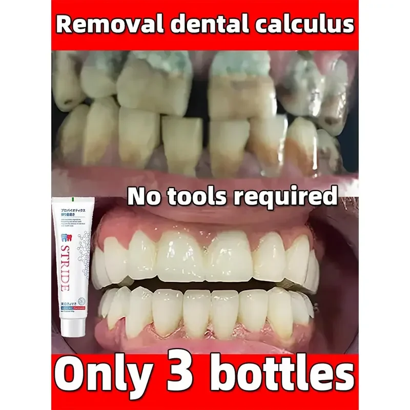 Removedor de cálculo Dental, pasta de dientes blanqueadora, eliminación de olores bucales, prevención del mal aliento, productos orales de