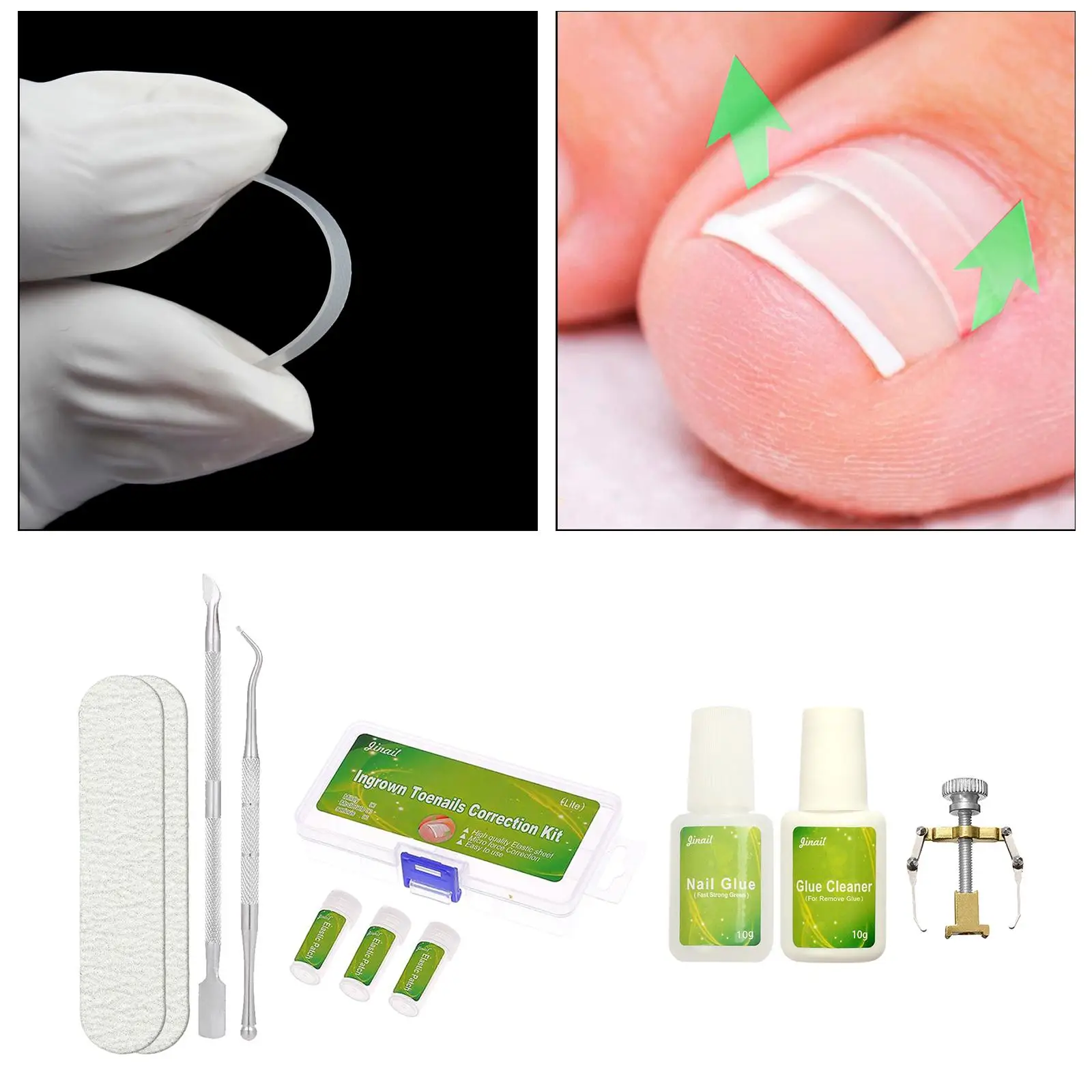 

10x Ingrown Toenail Straightening Clip Curved Brace Toenails Correction Tools