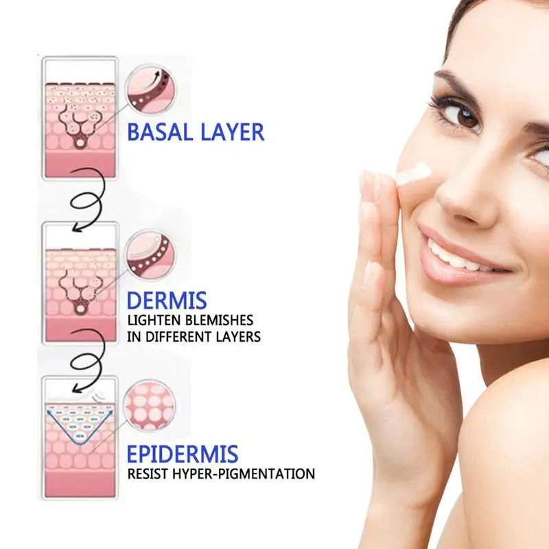 Become Beauty Ginseng Extract Whitening Cream Remove Freckles Whitening Freckle Spots Cream