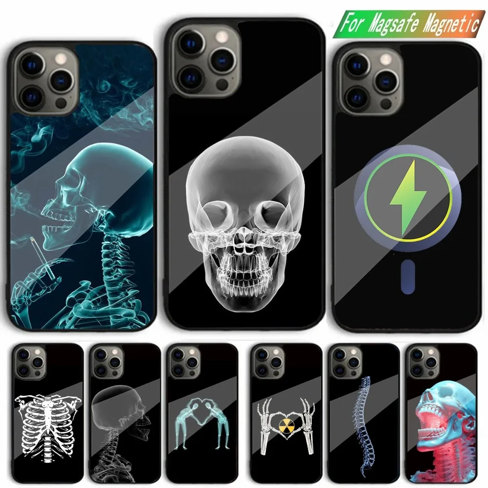 

Radiological Human Organs Skeleton Phone Case For iPhone 15,14,13,12,11,Plus,Pro,Max Mini Magsafe Magnetic Wireless Charging