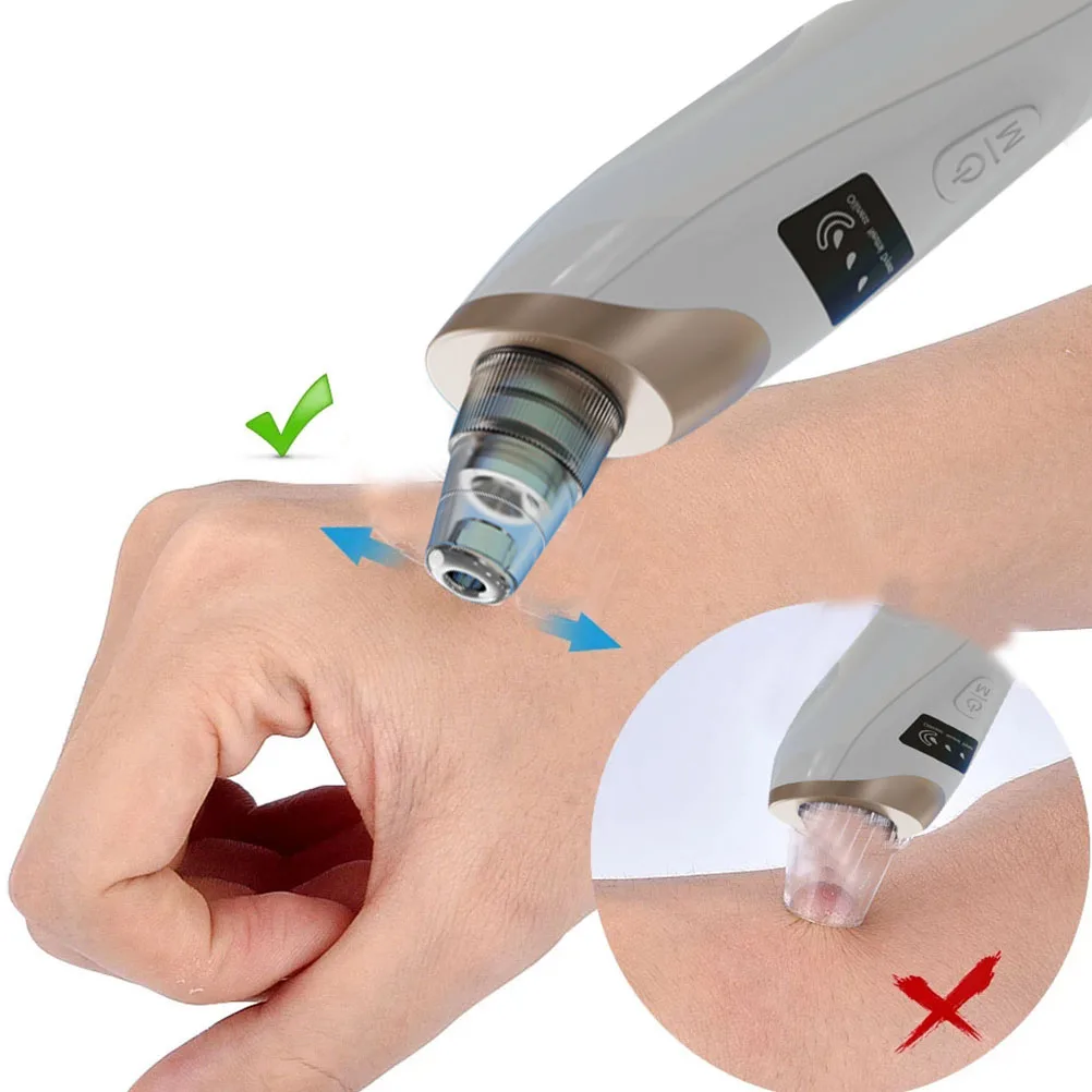 ไฟฟ้า Abs ทําความสะอาดรูขุมขนบนใบหน้าเครื่องมือดูแลผิวอุปกรณ์ทําความสะอาดลึกที่มีประสิทธิภาพ Extractor Beauty