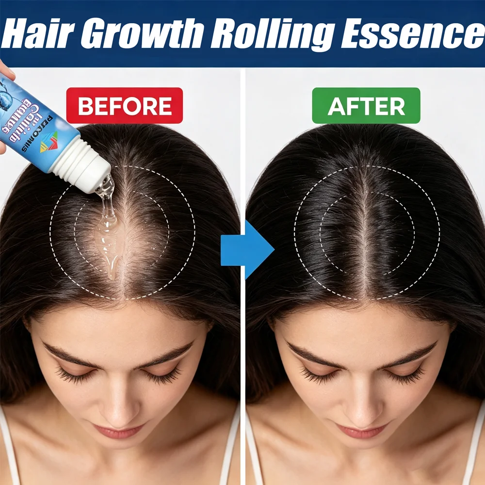 Panax Ginseng Hair Growth, Polygonum Multiflorum Hair Growth Essence lightweight, Hydrating, Non-Sticky, and Absorbs Quickly.