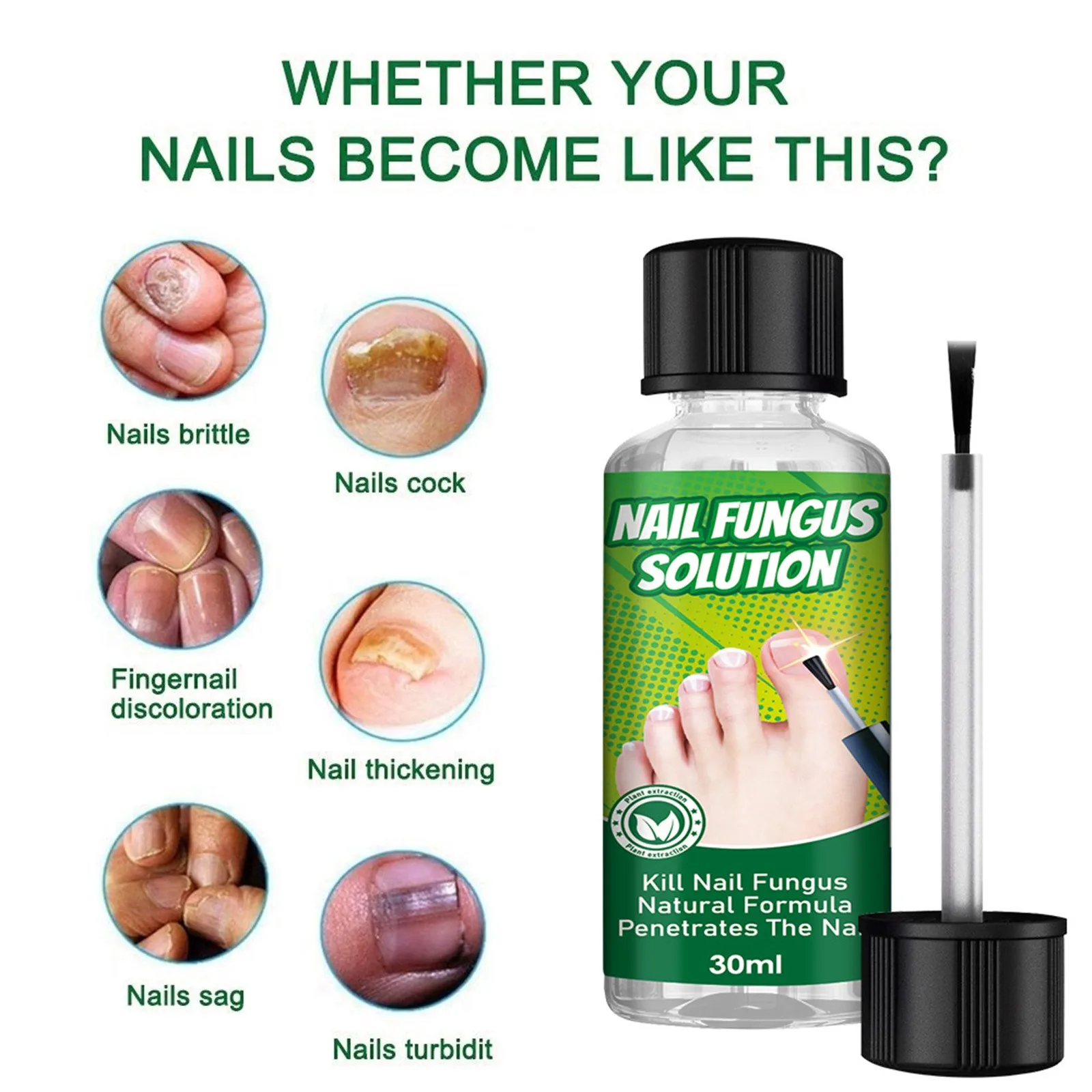 30ml Extra Strong Nail Fungus Treatment Serum Essence Oil Feet Nails Repair Care  Anti Infection Toe Fungal Removal Gifts