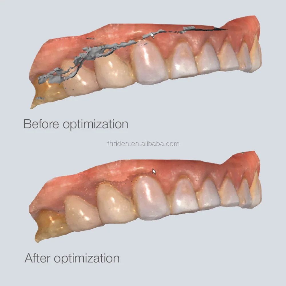 Miglior prezzo Attrezzatura da laboratorio odontoiatrico Scanner dentale 3D ad alta precisione Sistema di scansione CAD CAM Scanner intraorale 3D dentale brillante