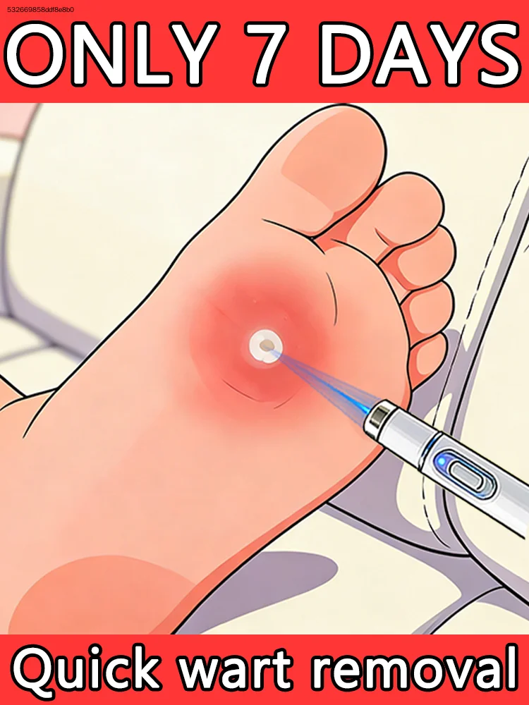 

2026 New Generation-3 Laser Says Goodbye To all warts In 7 Day