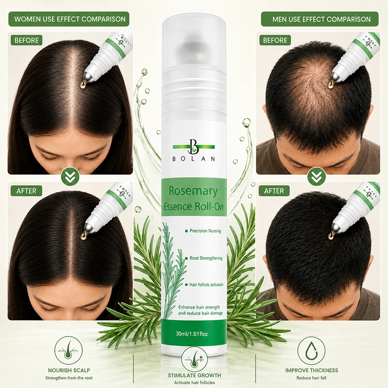Rosemary Hair Growth Roller Essence Promotes Scalp Health Stimulates Follicles Reduces Hair Breakage Increases Density