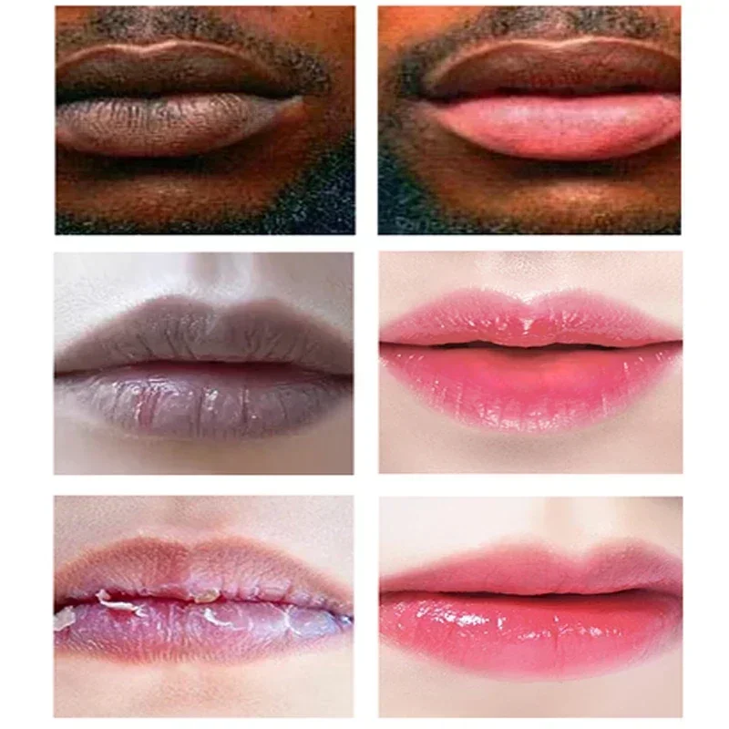 Lips Pink Fresh Whitening Serum Dark Lip Treatment Repair Sexy Pink Lip Essence Moisturizing Bleaching Dilute Melanin Lip Care