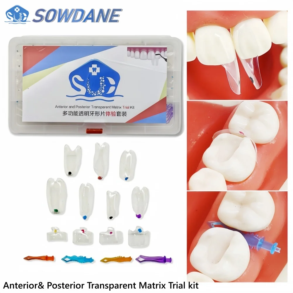 Dental Teeth Molar Bow Class Restoration Black Triangle Clear Matrix Anterior Posterior Fit Bioclear BT Transparent Matrices