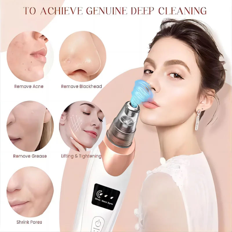 Nieuwste Technologie Comedondrukker Vacuüm Pore Cleaner voor Gezicht & Neus Mee-eter Verwijdering Kit Elektrische Acne Facial Extractor Tool