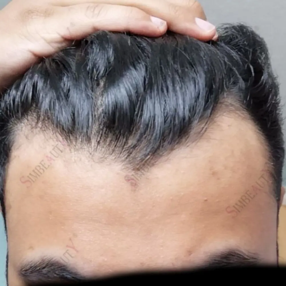 

Мужской парик-система из натуральных волос 0,02 мм, тонкий, невидимый, с естественной линией роста волос, протез для восстановления волос при облысении