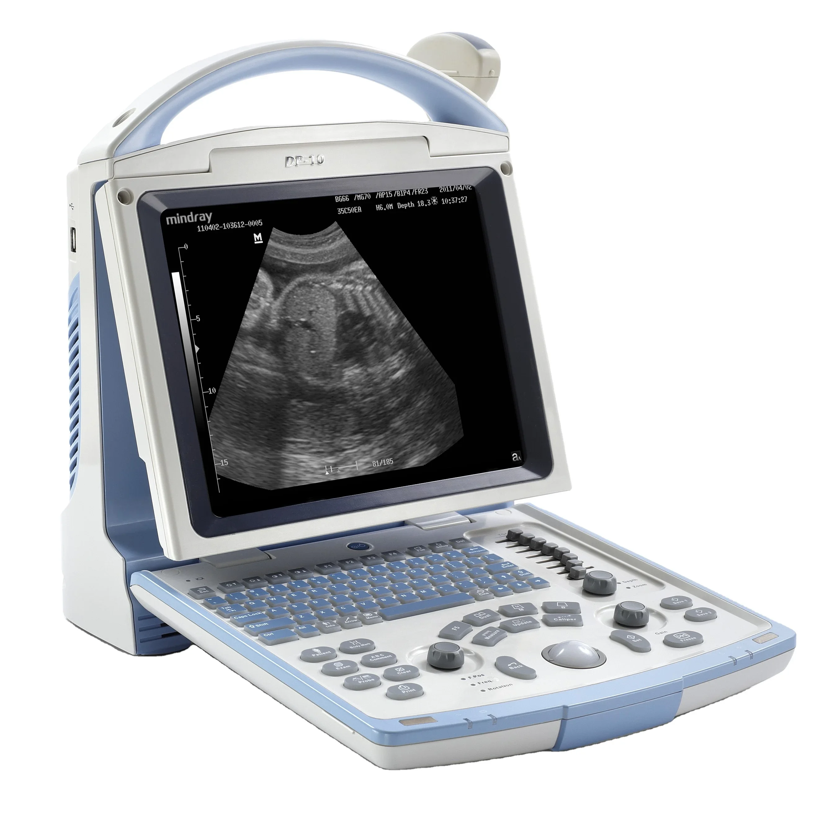 mindray dp 10 ultrasound  laptop mindray ultrasound portable ultrasound machine