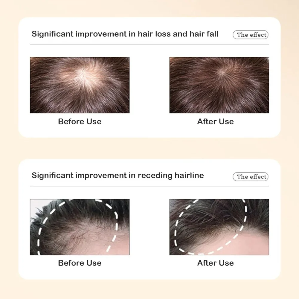 Hair Thickening Ginger Plant Extract Shampoo Replenish Hydration Promotes Hair Growth Anti-Hair Loss Hair Shampoo
