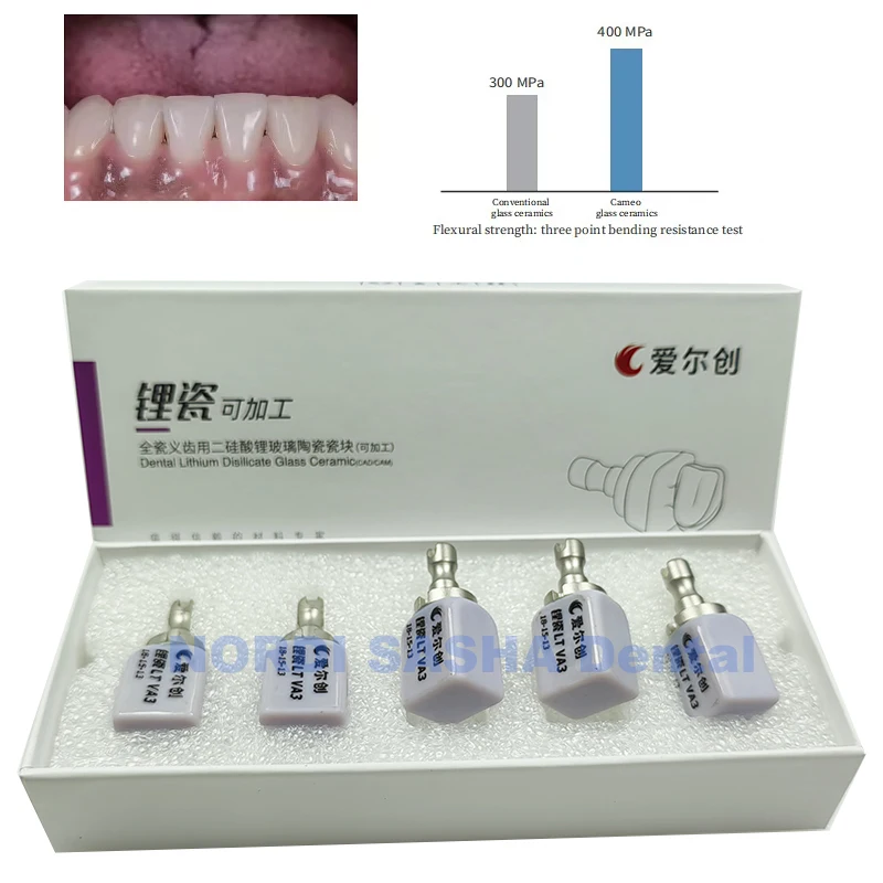 Upcera Dental Glass Ceramic Lithium Dislicate Block Cerec Emax CAD CAM HT LT C14 Blocks Excellent Restorative Effect 5Pcs/Box